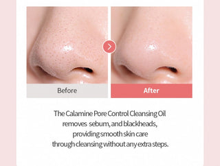 Calamine Pore Control Cleansing Oil, 200ml