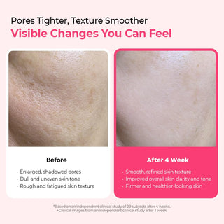 CEMENRETE CYANO PINK SPICULE SERUM 30ml