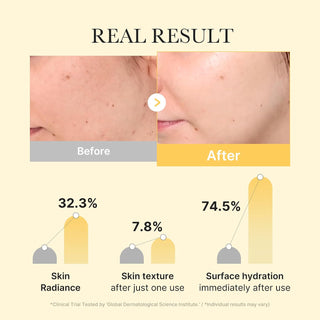 Kojic Acid Turmeric Brightening Gel Mask 4ea