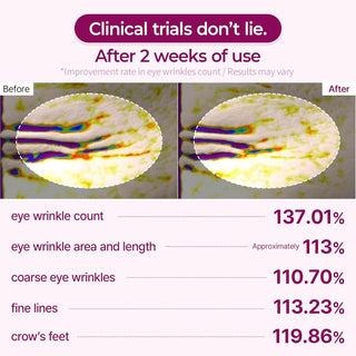 CEMENRETE CALCIUM VOLUME EYE PATCH 60EA