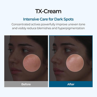 TX Cream 50g
