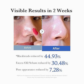 Zero Pore Pad 2.0, 70 Pads