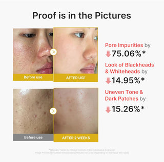 KOJIC ACID TURMERIC PEEL SHOT 80ml