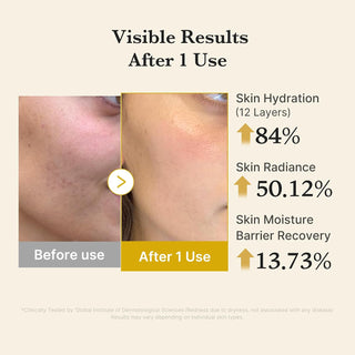 KOJIC ACID TERMERIC VITA JELLY MIST SERUM 100ml