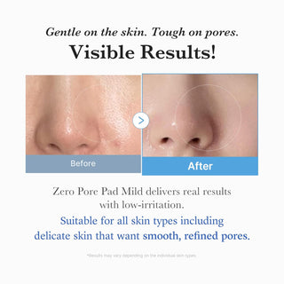 ZERO PORE PAD MILD (70pcs)
