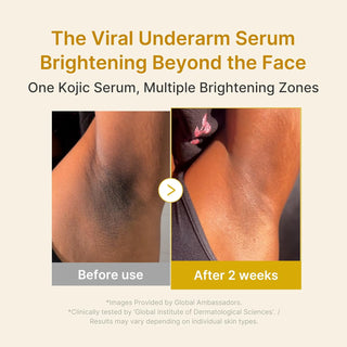 KOJIC  ACID TURMERIC NIACINAMIDE SERUM 30ML