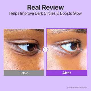 No.9 NAD Retinol Volumetox Eye Cream 10ml