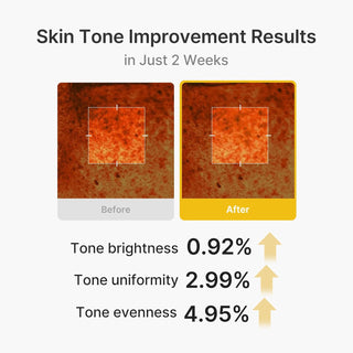 KOJIC ACID TURMERIC VITA CAPSULE CREAM, 53g