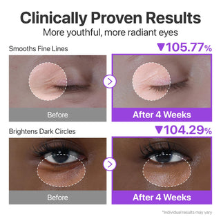 No.9 NAD Retinol Volumetox Eye Cream 10ml