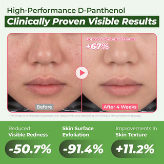 D-Panthenol Barrier Soothing Serum 70ml