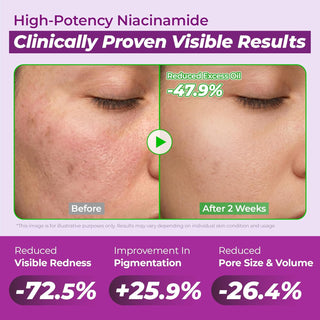 Niacinamide 10 Serum 40ml