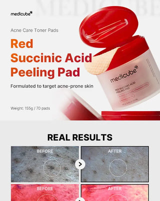 RED SUCCINIC ACID PEELING PAD, 70 pads