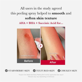 RED ACNE BODY PEELING SHOT 2.0 110g