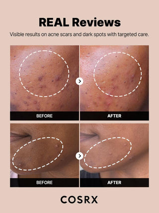 The Alpha-Arbutin 2 Discoloration Care Serum, 50ml