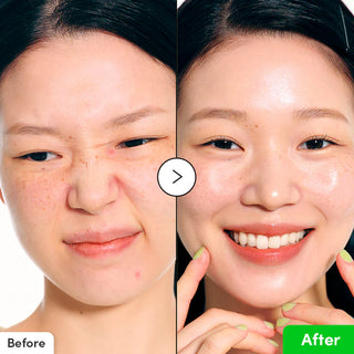 ALOE PDRN CALMING SERUM 30ML